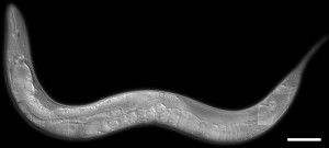 Il verme nematode Caenorhabditis elegans (Ian D. Chin-Sang, Queen`s University, Kingston, ON, Canada)