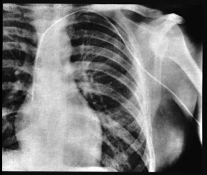 La radiografia sull’articolo del 1929 Credits: Wikimedia Commons