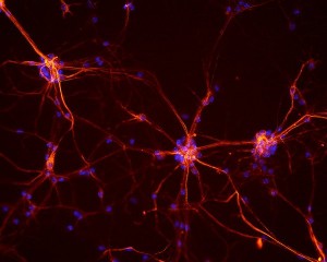 Neuroni di topi Credits: Flickr