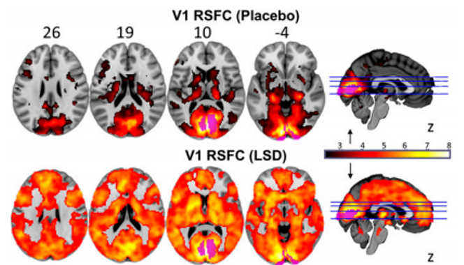 lsd img