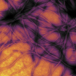 Immagine al microscopio di aggregati fibrillari di proteine prioniche estratte dal batterio E.coli