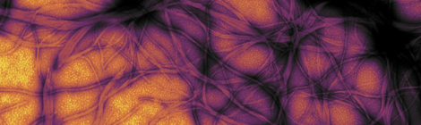Immagine al microscopio di aggregati fibrillari di proteine prioniche estratte dal batterio E.coli