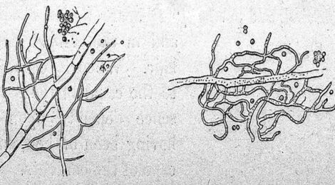 Penicillium glaucum, immagine del 1854 credits: www.commons.wikimedia.org (licenza CC)