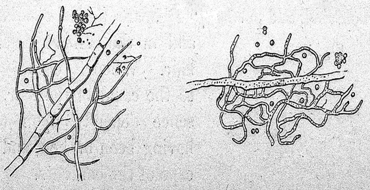 Penicillium glaucum, immagine del 1854 credits: www.commons.wikimedia.org (licenza CC)