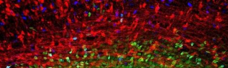 Corteccia cerebrale in via di sviluppo. Alla base in blu e verde sono visibili due tipi di progenitori neurali, nel resto dell'immagine in rosso giovani neuroni in via di sviluppo