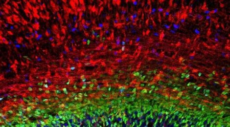 Corteccia cerebrale in via di sviluppo. Alla base in blu e verde sono visibili due tipi di progenitori neurali, nel resto dell'immagine in rosso giovani neuroni in via di sviluppo