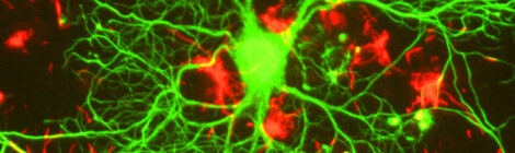 Scoperti i neuroni che ci permettono di ricordare i volti