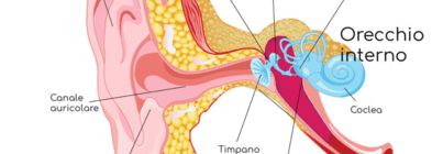 Primo intervento di impianto per il sistema vestibolare in Italia